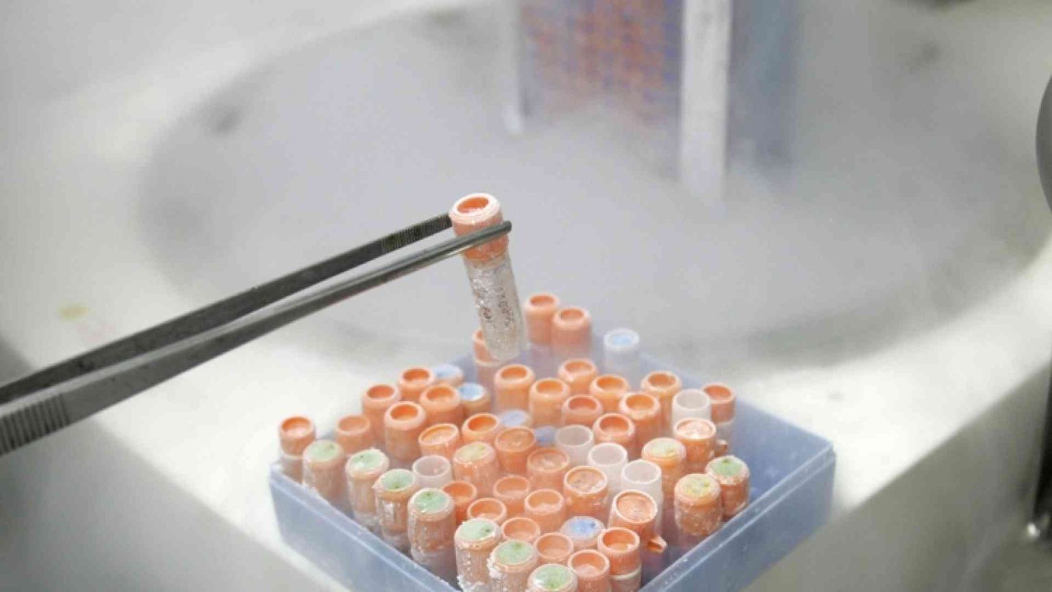 Test sull’embrione e il limite di 14 giorni