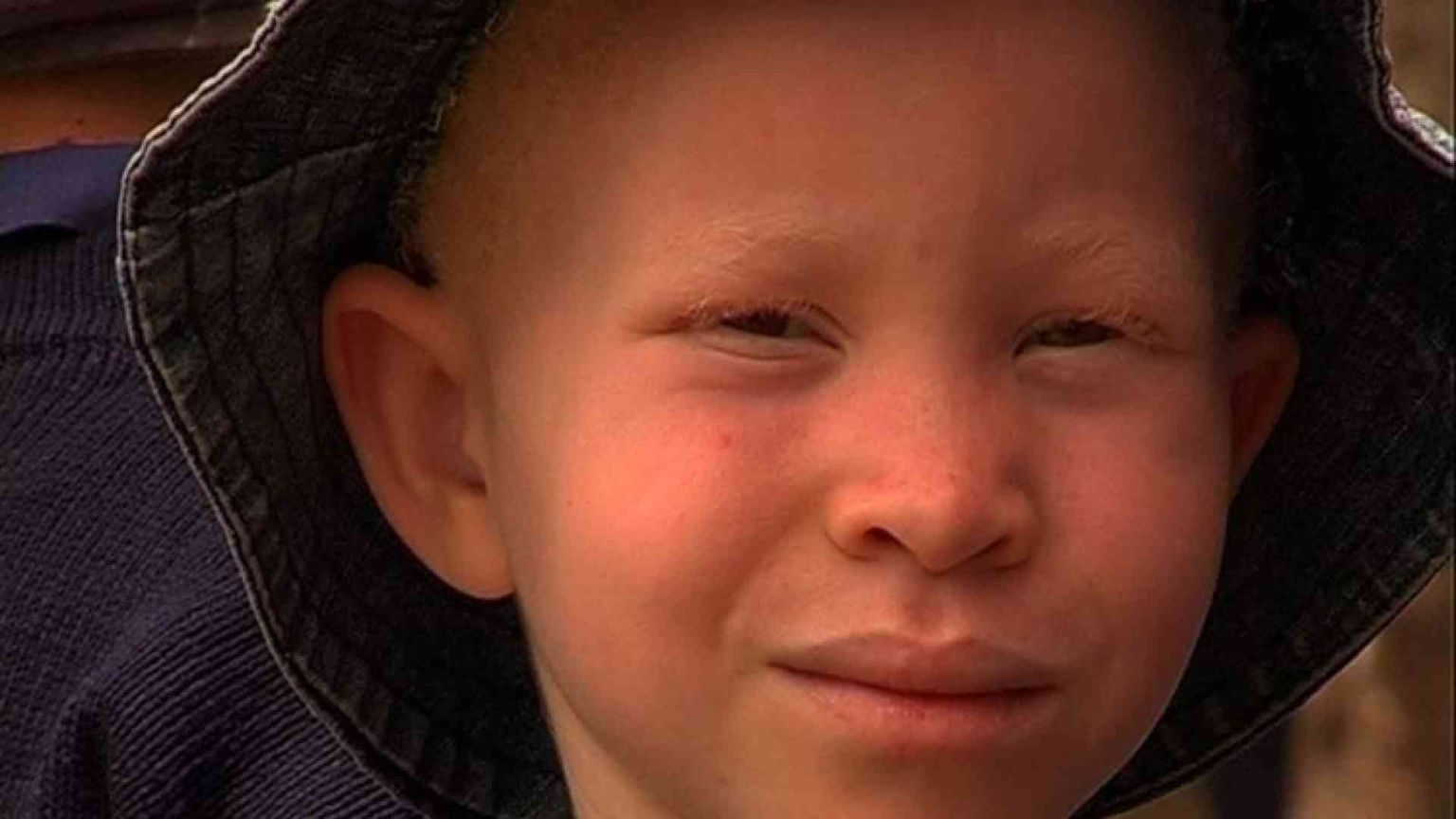 «Albini, in Africa massacro senza precedenti»