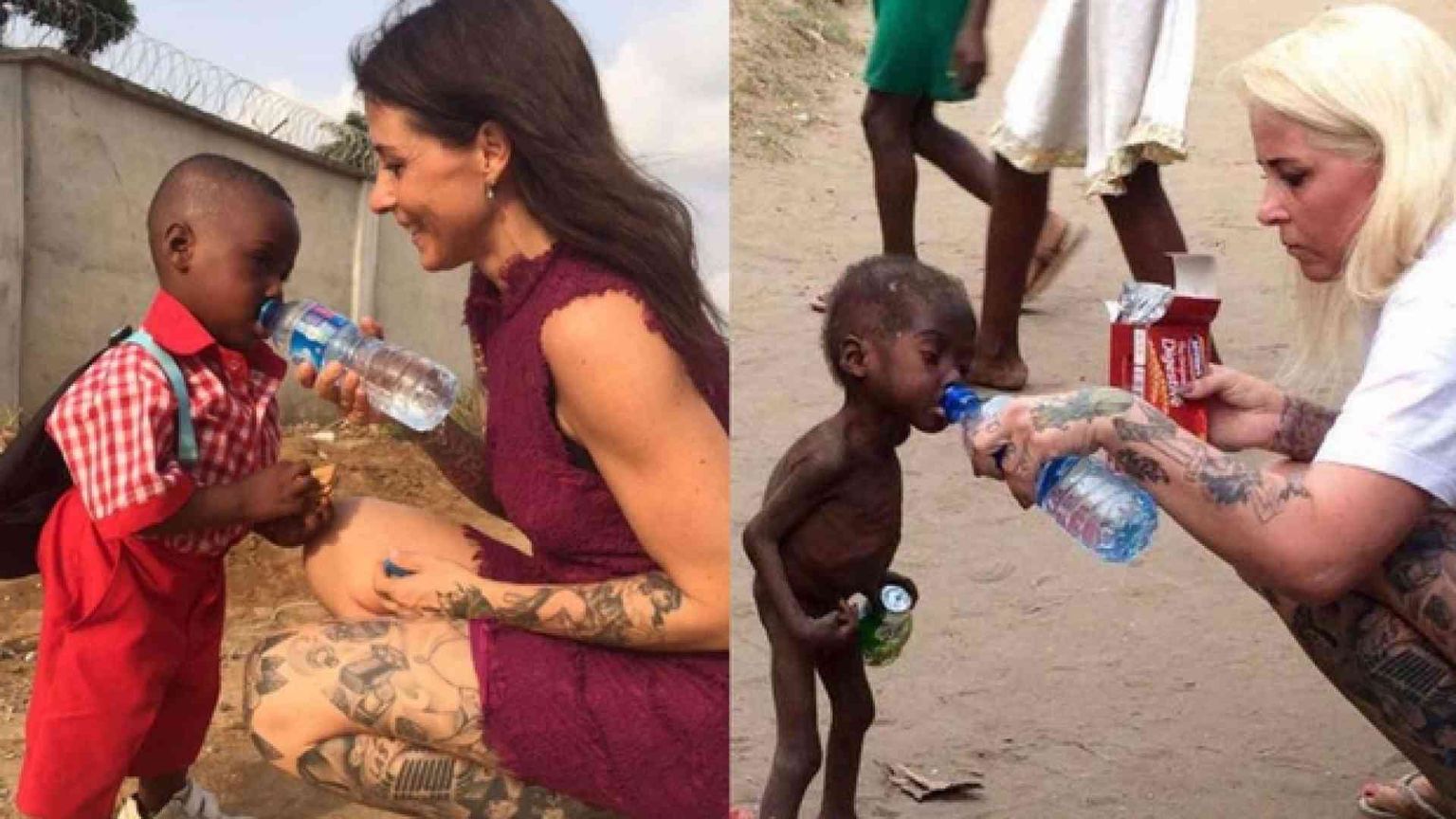 Ecco com'è rinato Hope, il bimbo condannato a morte dalla nascita