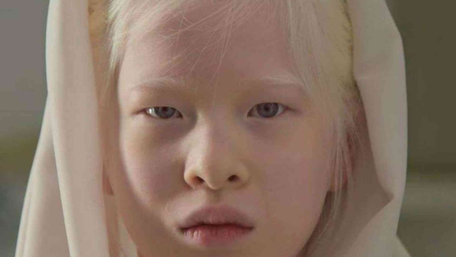 Xueli, la bambina albina abbandonata diventa modella