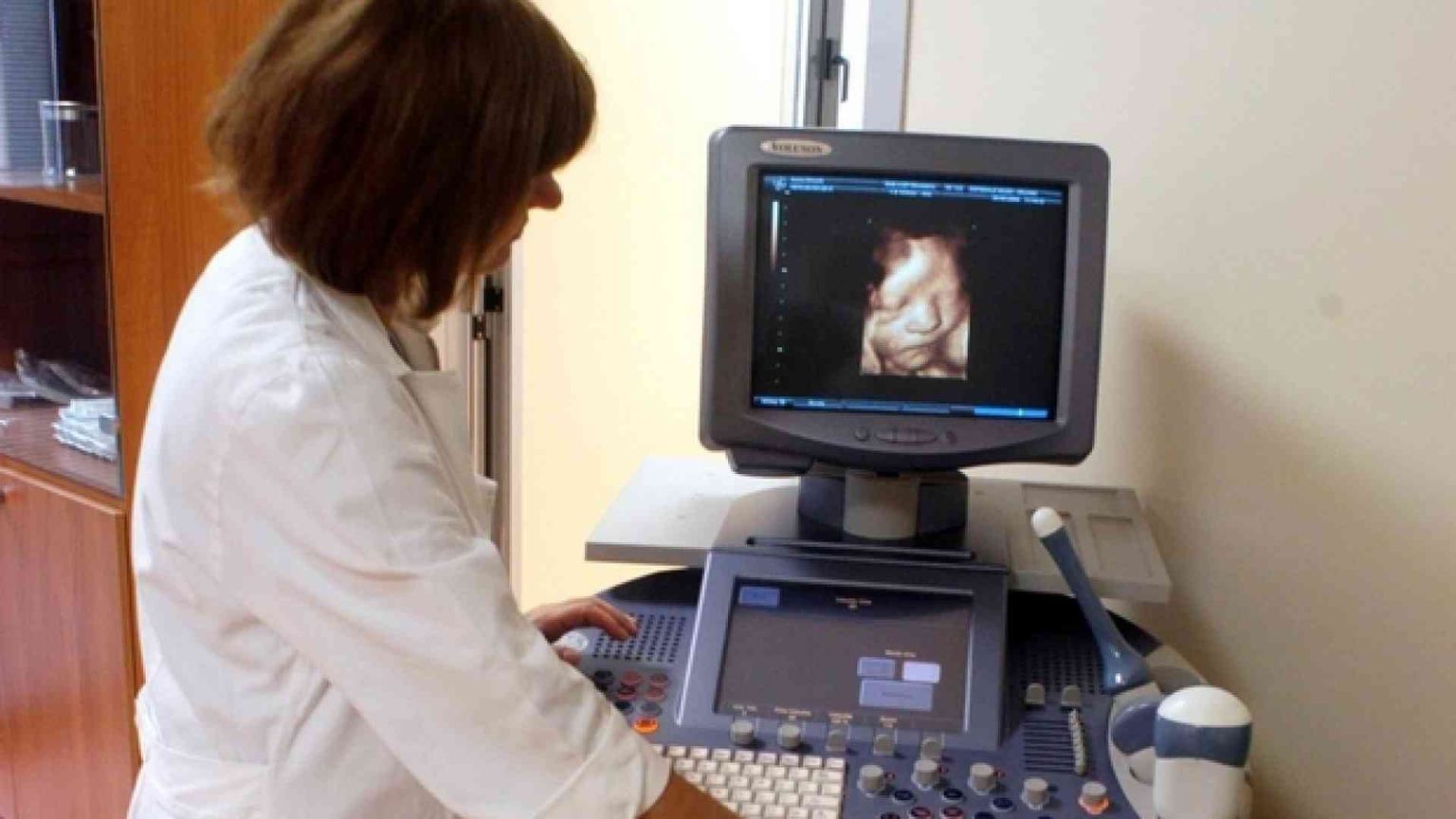 Aborti selettivi, caso a Treviso. «Neonati Down spariti»