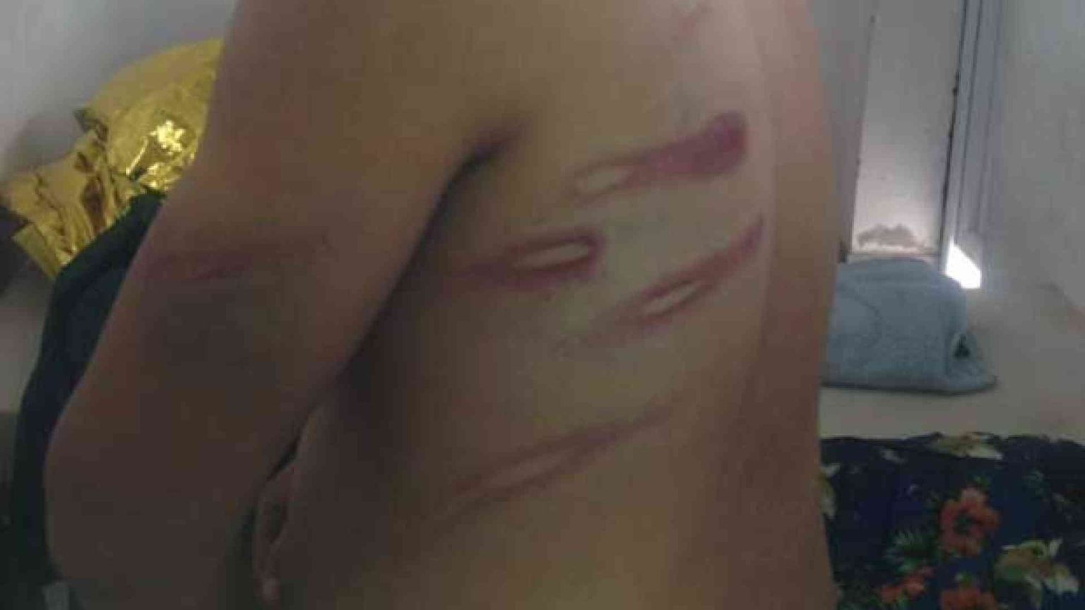 «Violati i diritti umani dei migranti nei centri di Lampedusa e Potenza»