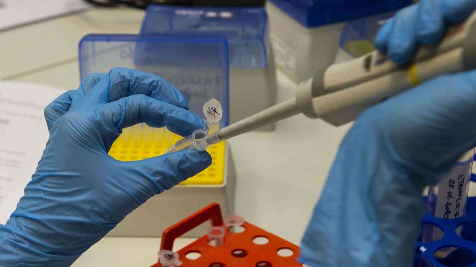 «Non è la peste, ma neanche l'influenza. Ecco perché»