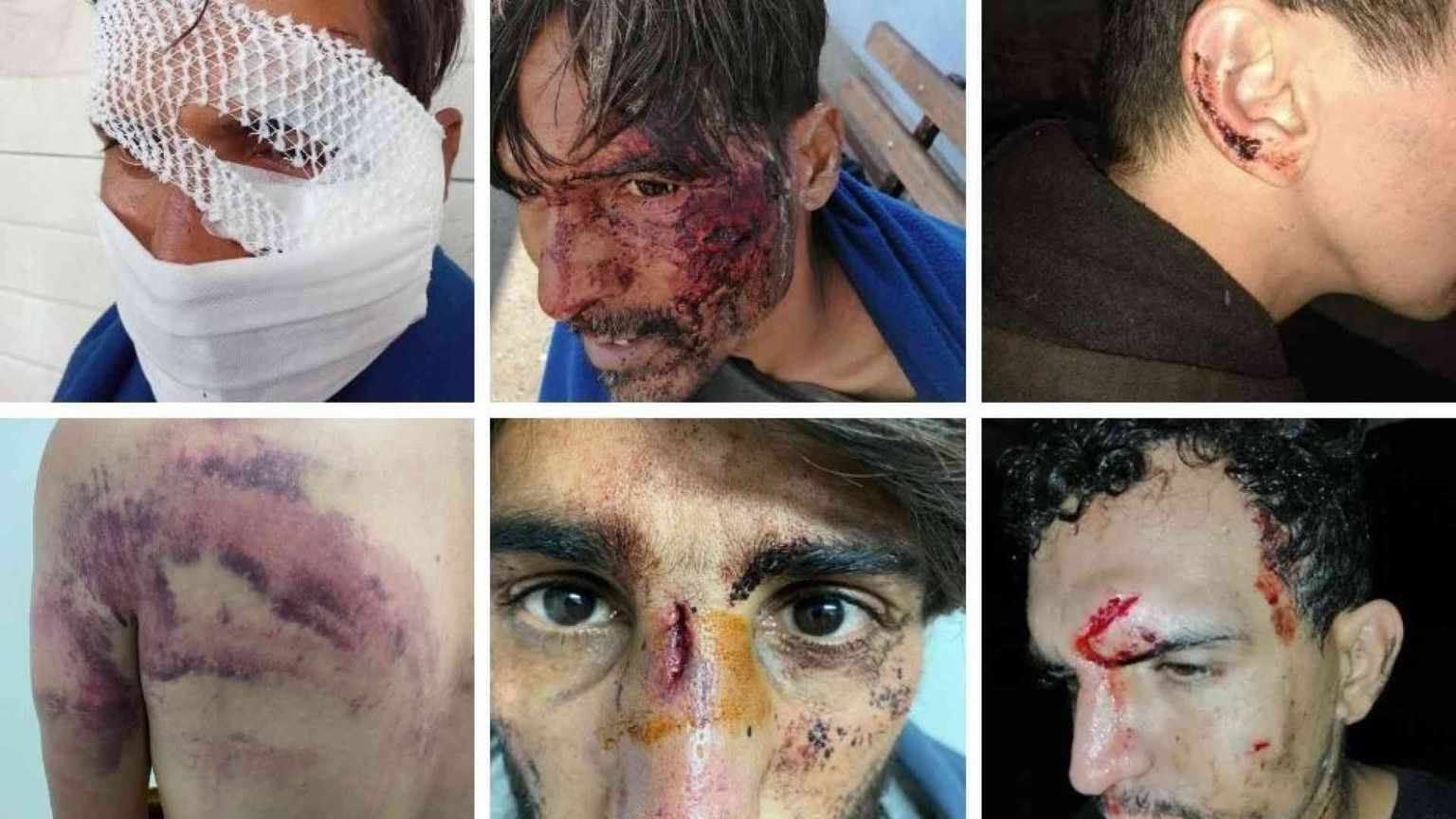 Sulla rotta balcanica delle migrazionI