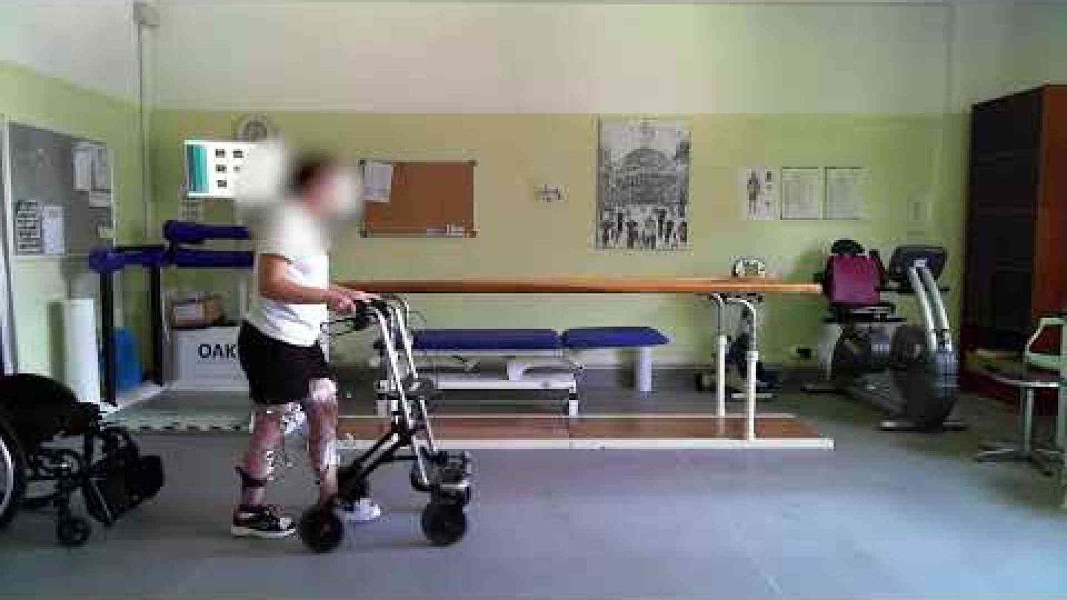 Un "pacemaker" alla colonna vertebrale. E Anna torna a camminare