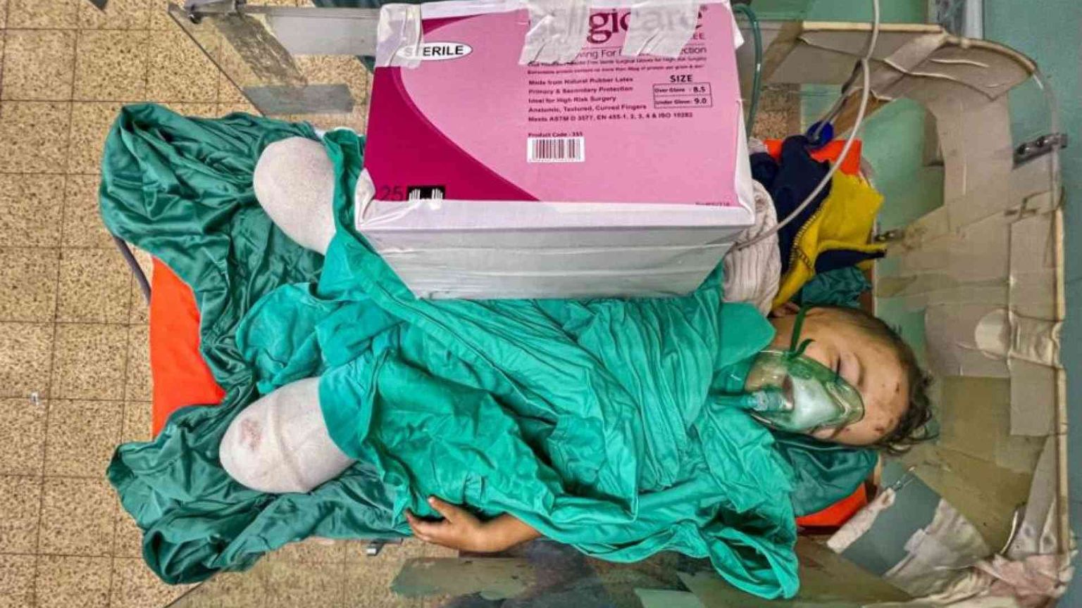 La tragedia di Gaza nella foto del bambino con le gambe amputate