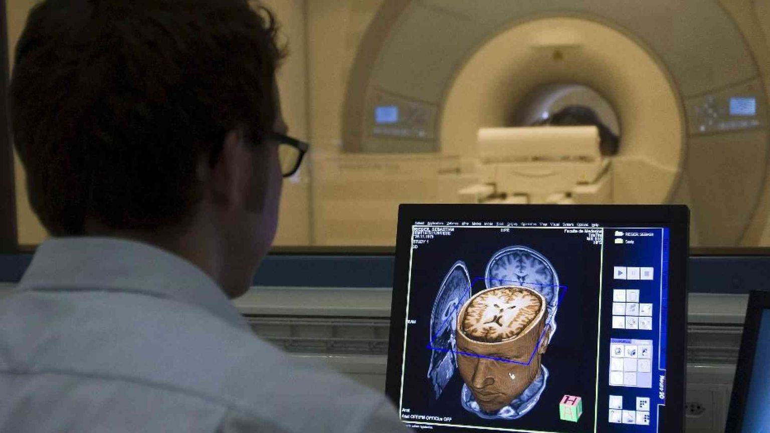 Avatar digitali, diagnosi, farmaci. Nasce il Cern italiano del cervello