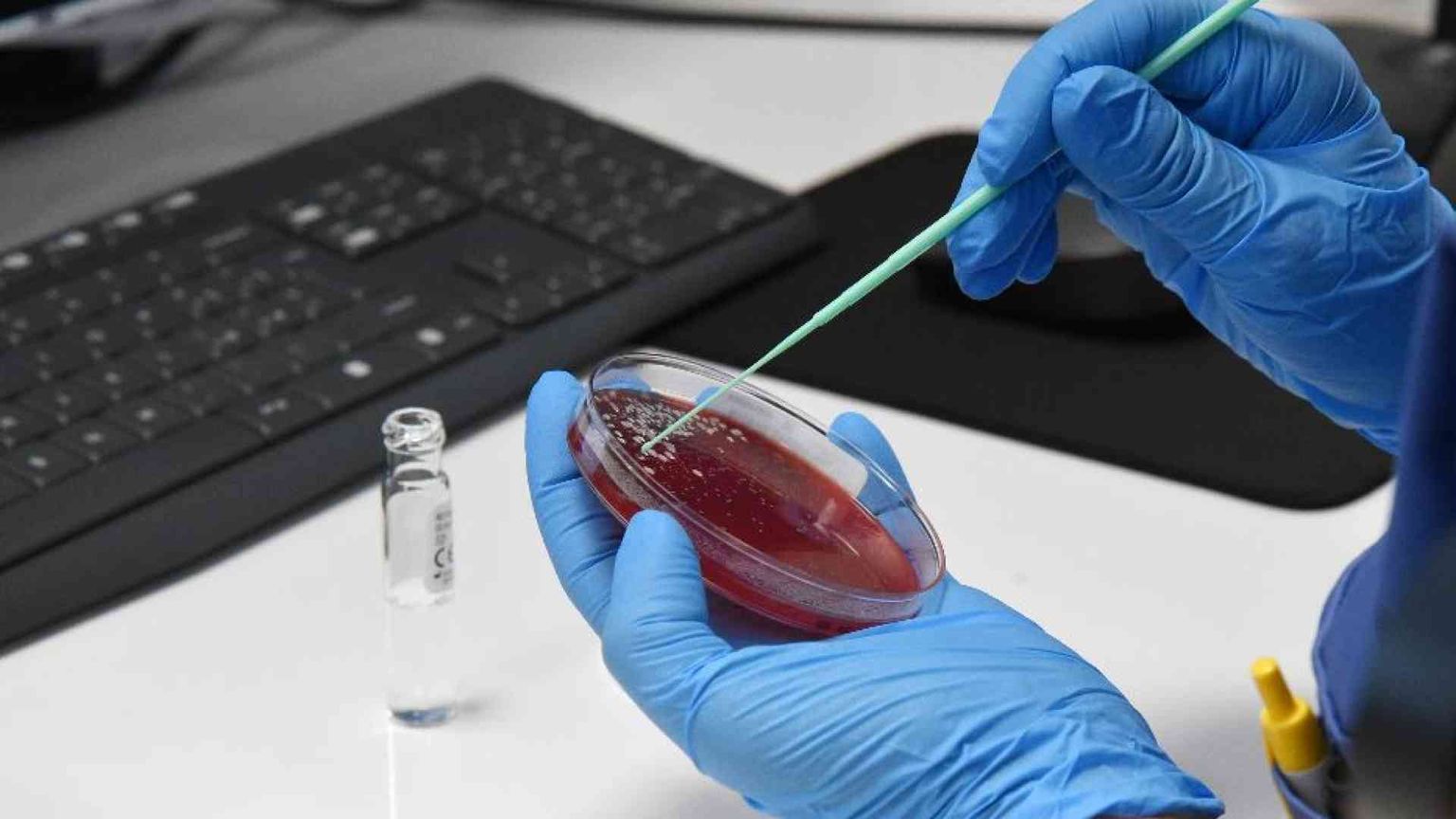 Malattie rare, in Italia 100mila senza diagnosi