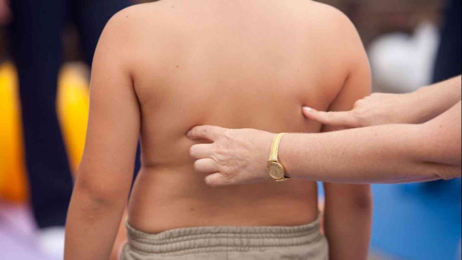 Un bambino su 3 in eccesso di peso: troppo cibo e poco movimento