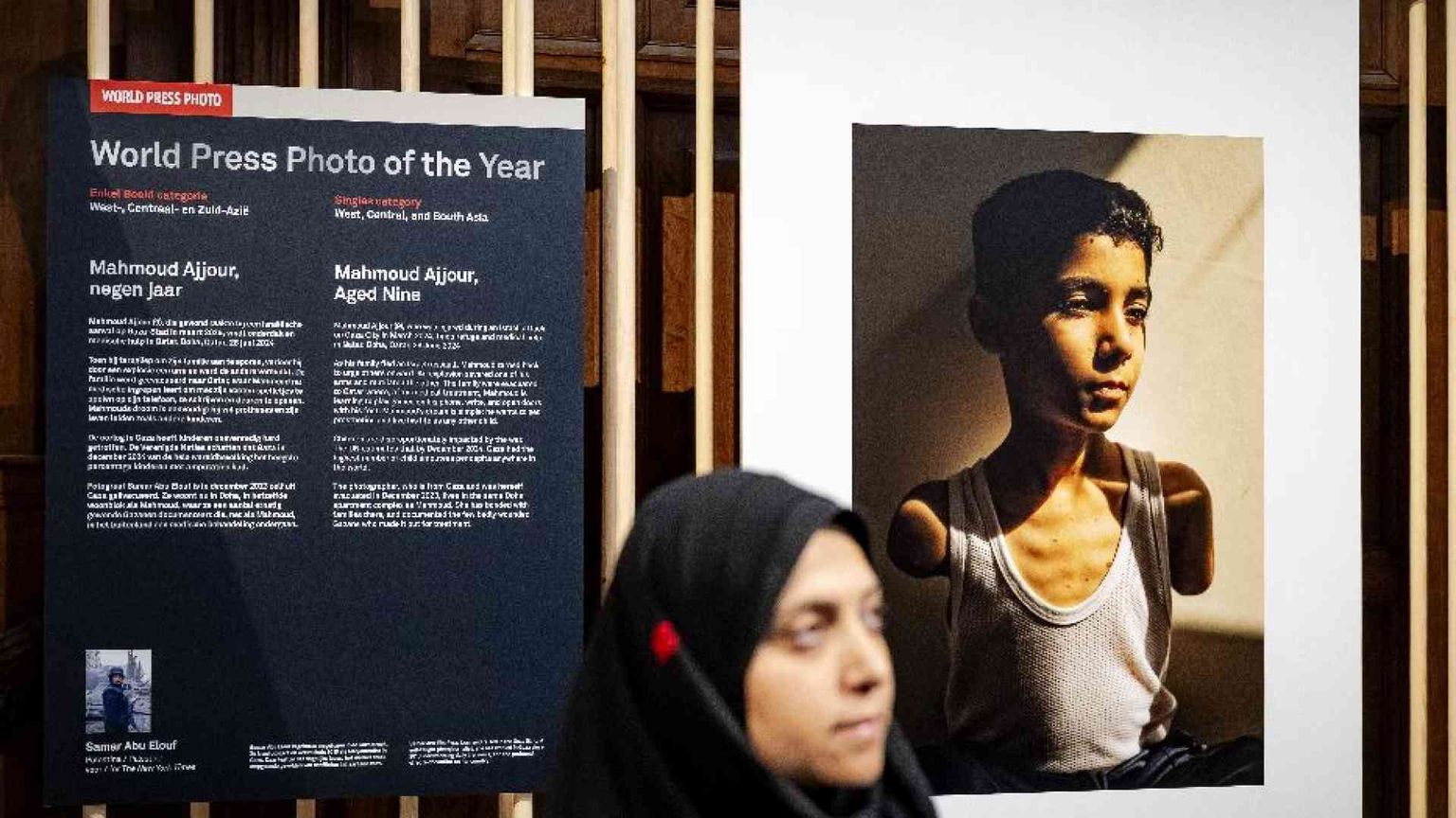 Vince il World Press Photo l'immagine di un bimbo amputato di Gaza