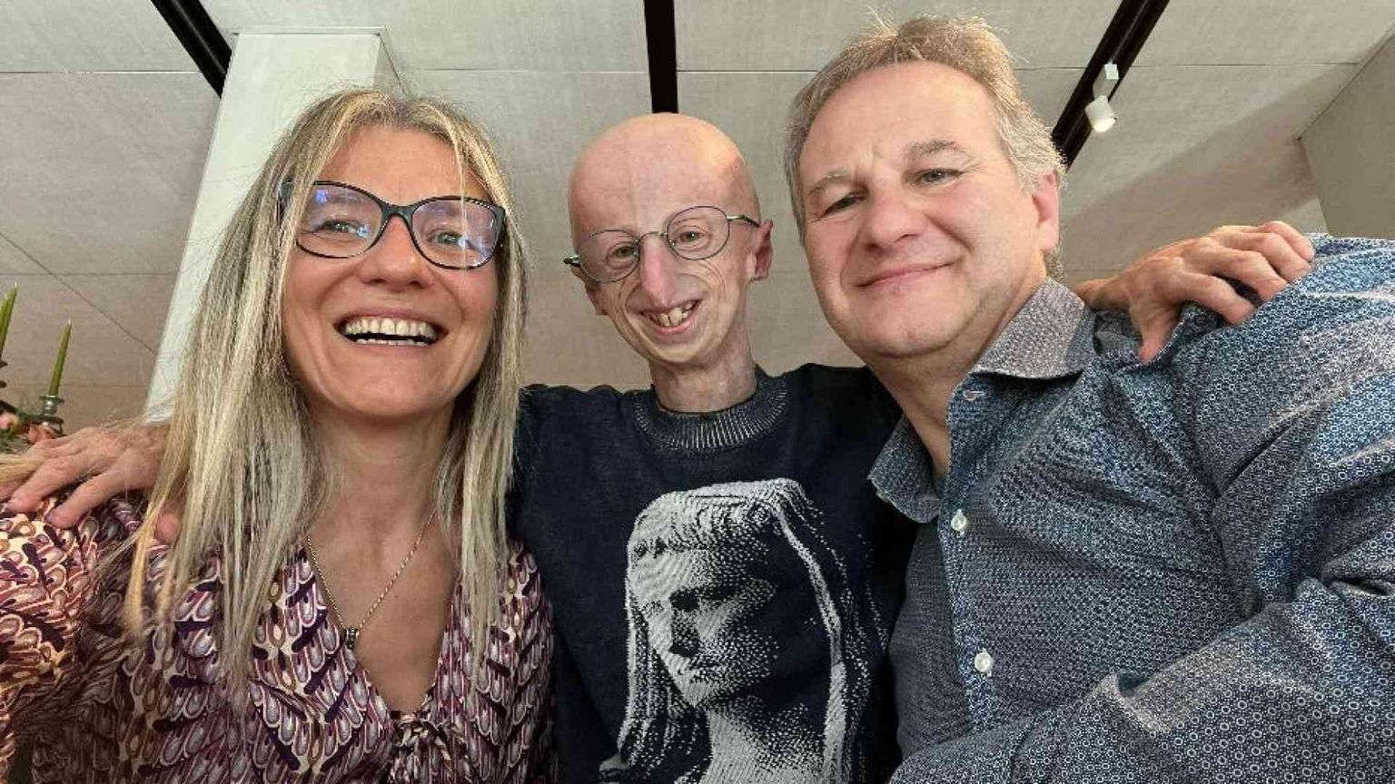 «Mio figlio Sammy Basso e gli studi per curare la malattia (ma non per sé)»