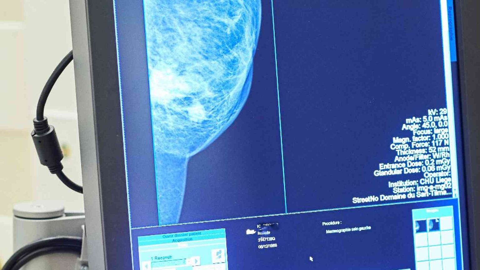 Nelle nuove prestazioni sanitarie più esami preventivi per i tumori