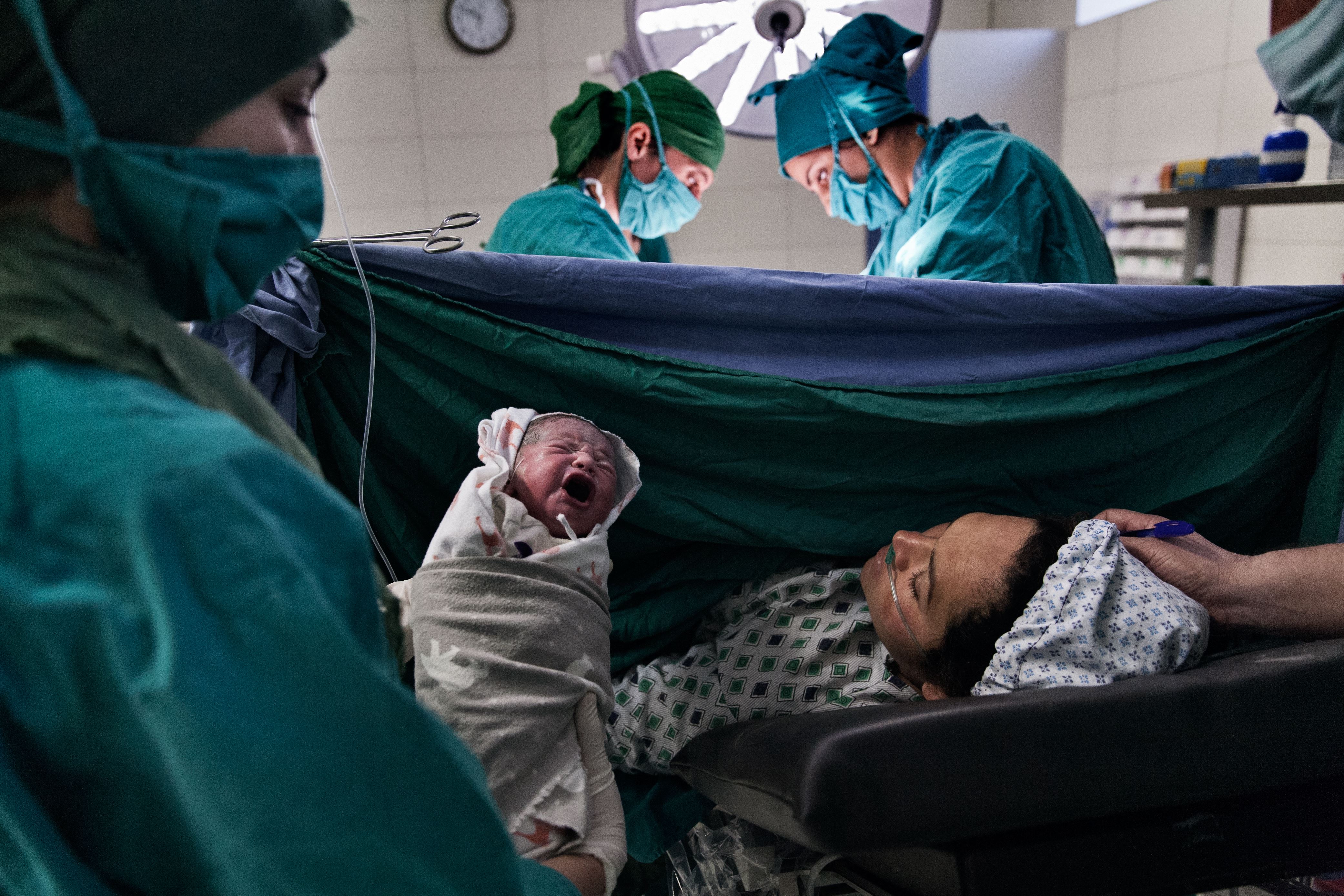 Maternità, sala operatoria, parto cesareo della figlia di Vida, 28anni. È il 4° cesareo di Vida.