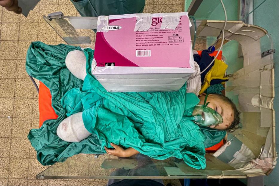 Il bambino di Gaza di due anni a cui oggi sono state amputate le gambe, come a suo padre. Il resto della famiglia non c'è più, sterminata da una bomba israeliana