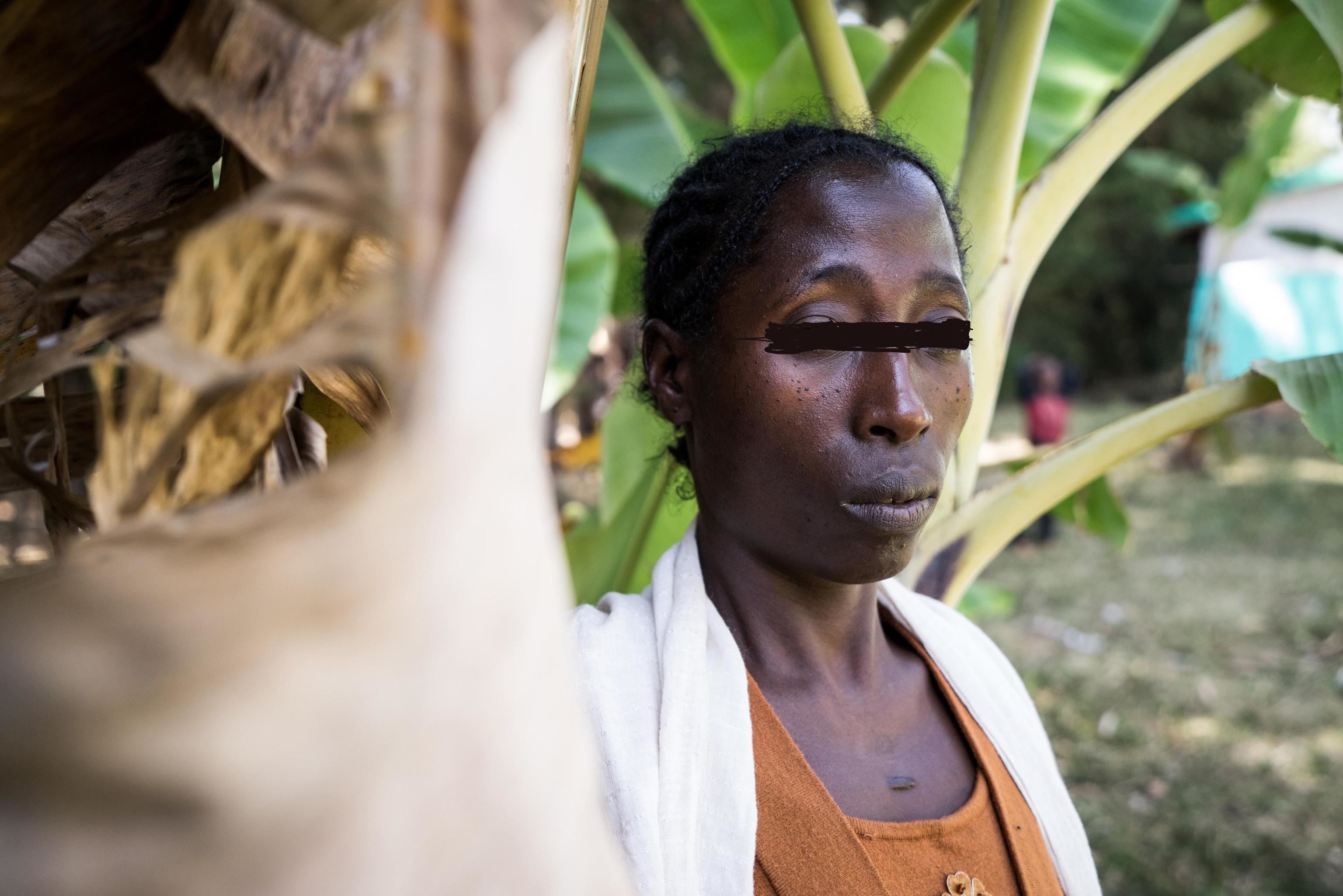 Mutilazioni genitali, morte tre ragazze in Sierra Leone